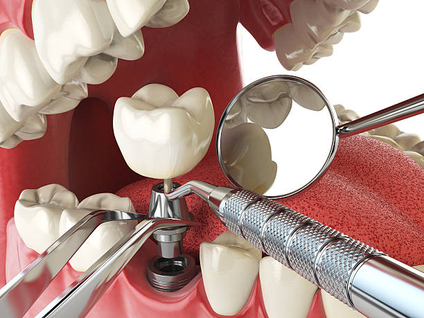 Best Cosmetic Emergency Dentistry in Lynchburg, MS